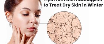 Important-Tips-from-Dermatologists-to-Treat-Dry-Skin-in-Winter
