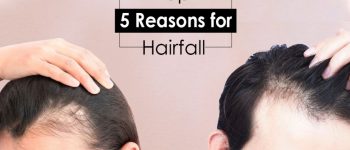 Top-5-reasons-for-hair-fall_1662379430_1000X580_c_c_0_0