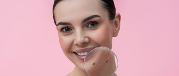 fpkdl.com_960_close-up-woman-face-with-birthmarks_259150-83131 (1)