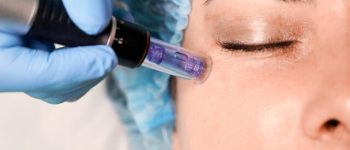 [freepicdownloader.com]-female-client-having-fractional-mesotherapy-beauty-salon-large