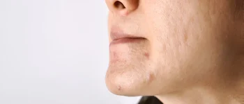 steptodown.com529568